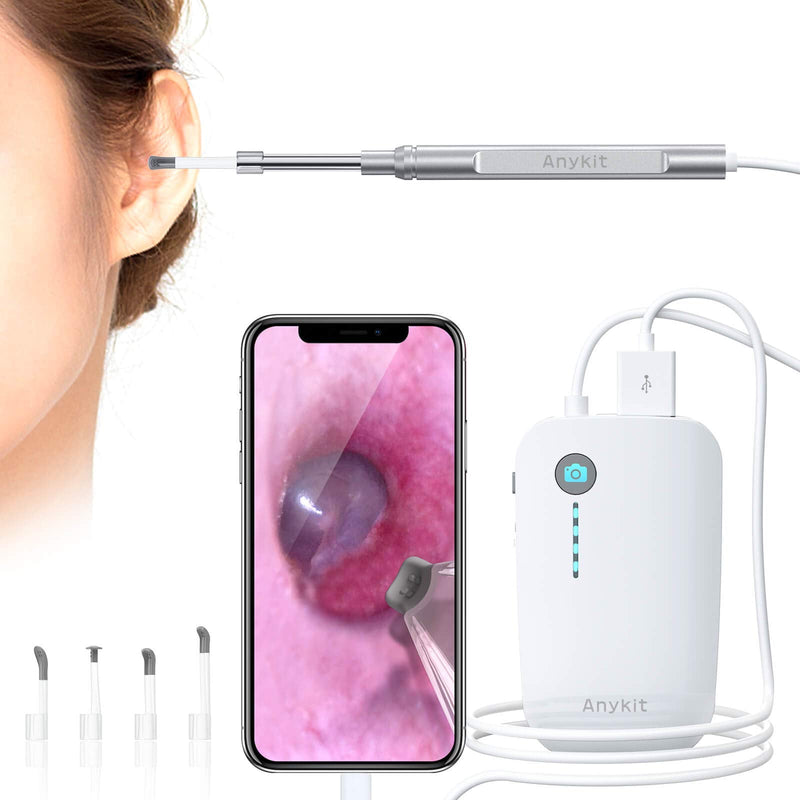  [AUSTRALIA] - Anykit USB Otoscope Camera for iPhone & Android, 720P HD Visual Ear Camera with Lights, Ear Scope with Ear Wax Removal Tool & Storage Case, Ear Endoscope for Kids, Adults & Pets