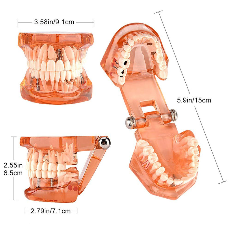  [AUSTRALIA] - Tooth Model For Teaching, Teeth Model of Tooth Degeneration Demonstration Study Orange Dental Model Dentures