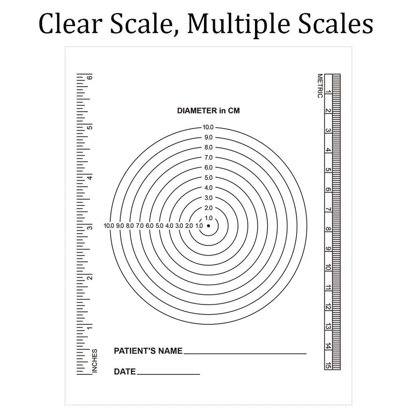  [AUSTRALIA] - Edtape (Pack of 100) Wound Measurement Tools Wound Measuring Bullseye Guide Wound Measuring Ruler Medical Ruler Wound Measuring Tool Device Wound Measure Guide