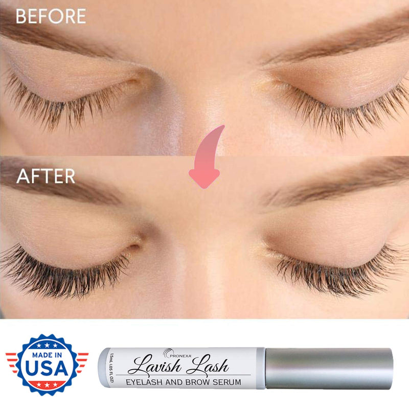 Pronexa Hairgenics Lavish Lash – Eyelash Growth Enhancer & Brow Serum with Biotin & Natural Growth Peptides for Long, Thick Lashes and Eyebrows! Dermatologist Certified, Cruelty Free & Hypoallergenic. - LeoForward Australia